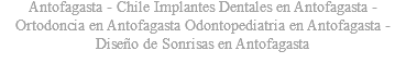 Antofagasta - Chile Implantes Dentales en Antofagasta - Ortodoncia en Antofagasta Odontopediatria en Antofagasta - Diseño de Sonrisas en Antofagasta